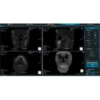 Tomógrafo Saevo 3D UP + Panorâmico - imagem 4