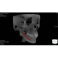 Tomógrafo Saevo 3D UP + Panorâmico - imagem 2