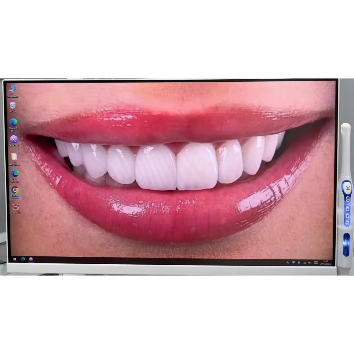 Kit Multimídia com Câmera Intraoral 24.5 polegadas - PRIME WELT