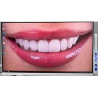 Kit Multimídia com Câmera Intraoral 24.5 polegadas - PRIME WELT - imagem 1
